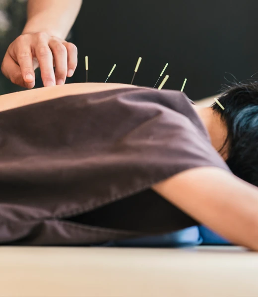 Acupuncture Anchorage AK Acupuncture Back