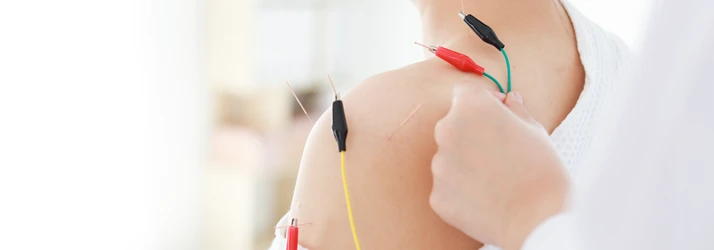 Acupuncture Anchorage AK Electro Acupuncture Shoulder