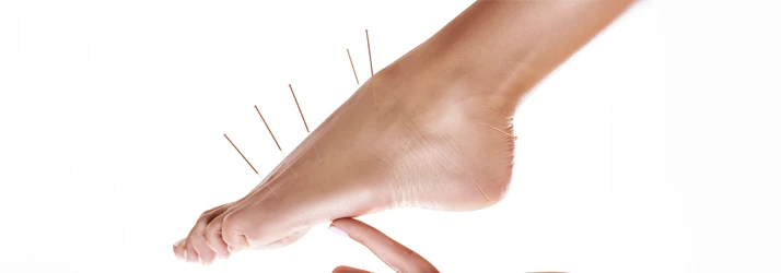 Acupuncture Anchorage AK Foot Acupuncture